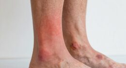 distinguishing soreness from injury