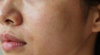 identify your skin type